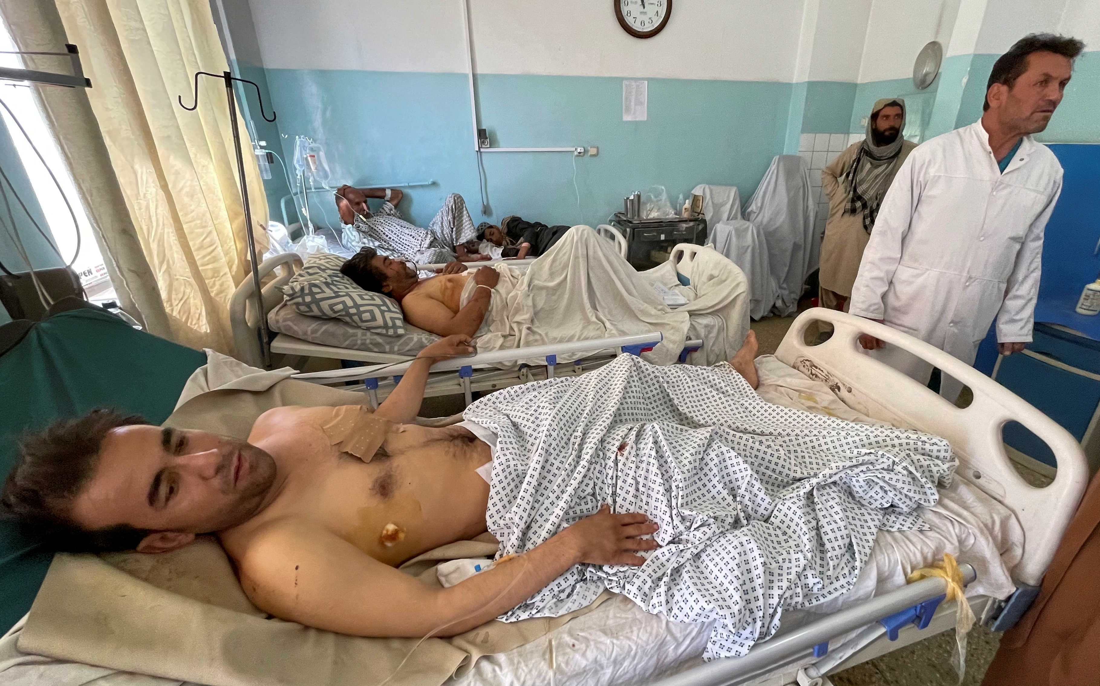 Wounded Afghan men receive treatment at a hospital after yesterday's explosions outside airport in Kabul