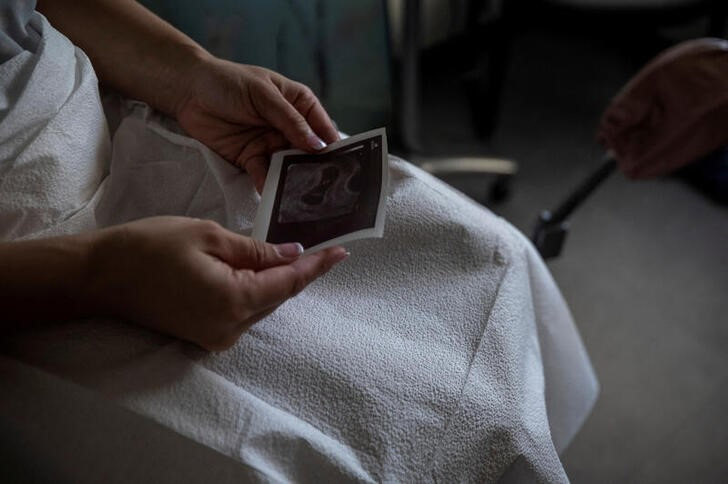 A patient looks at her ultrasound before proceeding with a medical abortion at Alamo Women's Clinic in Albuquerque