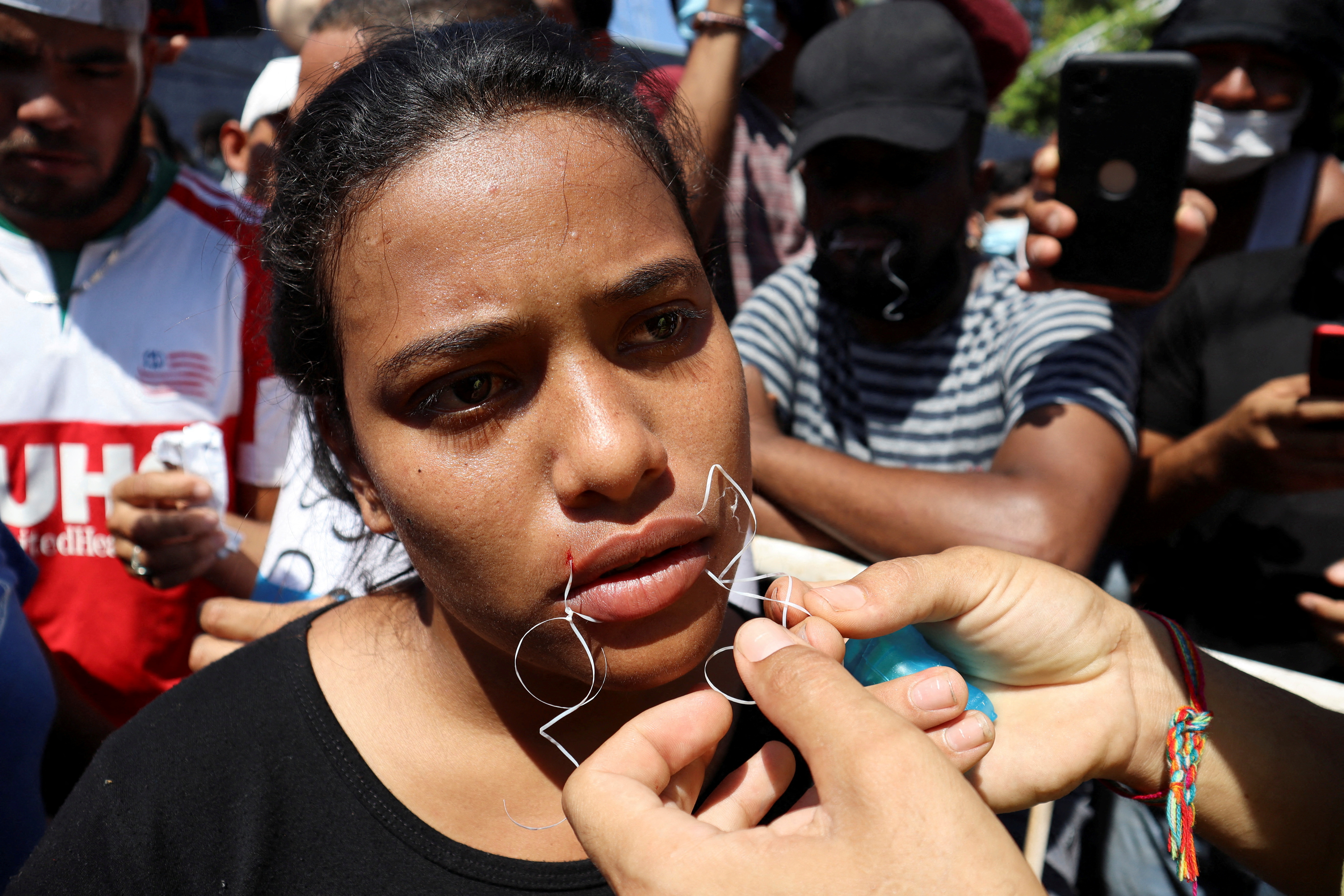 A migrant begins a hunger strike with her mouth sewed shut during a protest to demand free transit through the country outside the office of the National Migration Institute (INM) in Tapachula