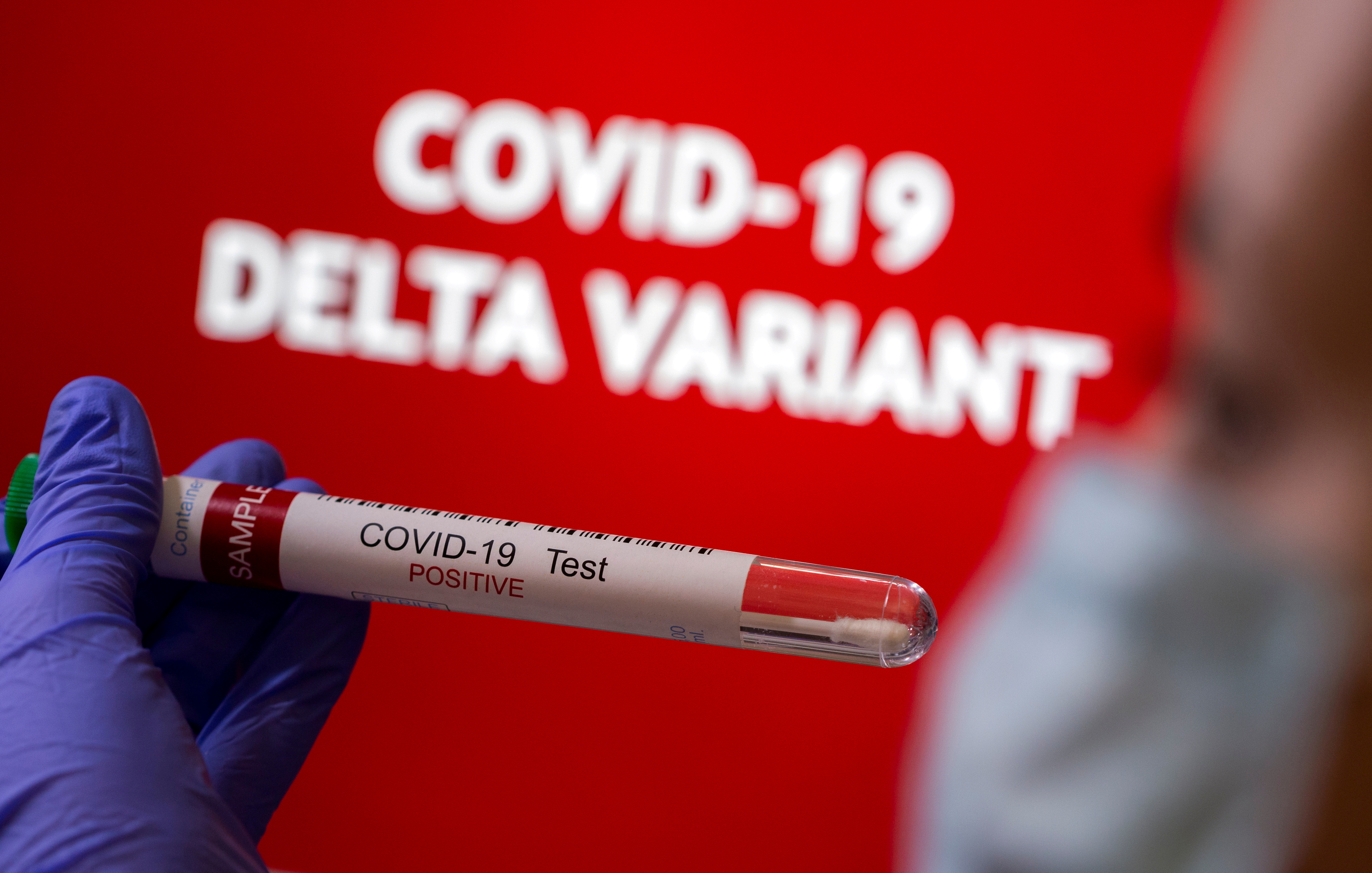 FILE PHOTO: Illustration of a test tube labelled 'COVID-19 Test Positive' in front of displayed words 'COVID-19 Delta variant'