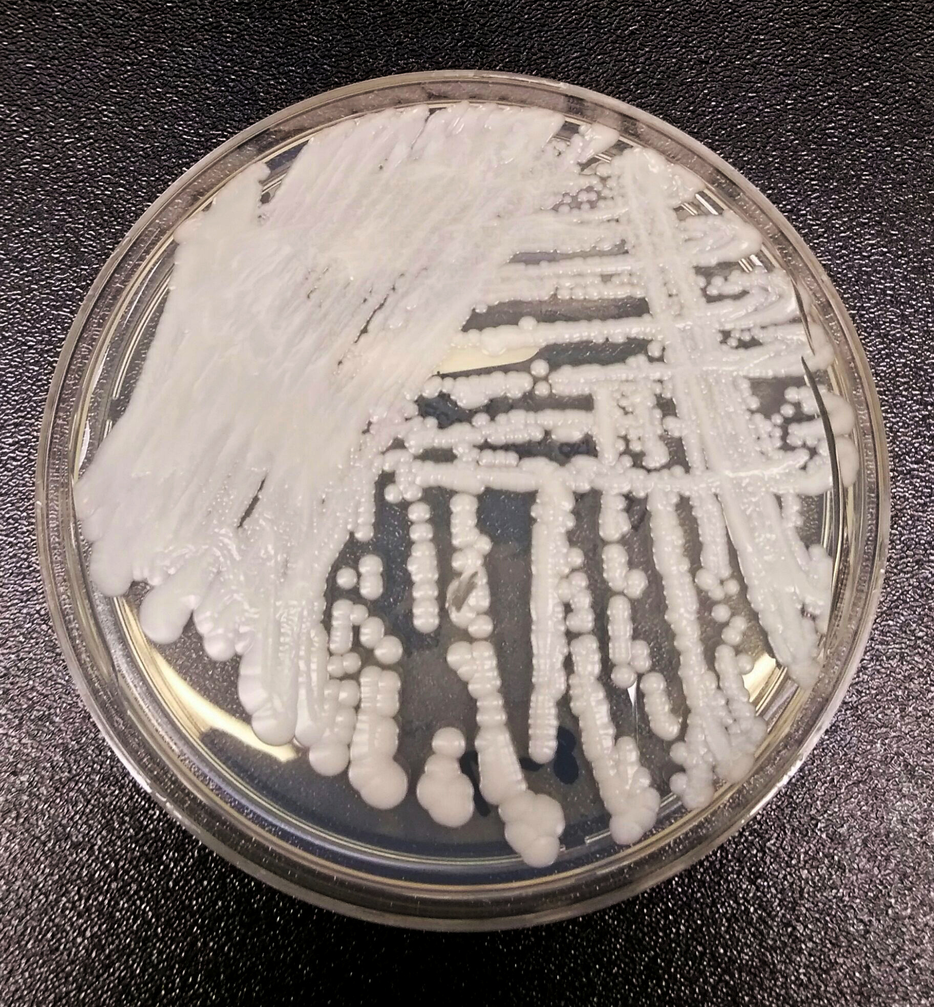 A strain of Candida auris cultured in a petri dish at the Centers for Disease Control and Prevention (CDC) is pictured in this handout photo
