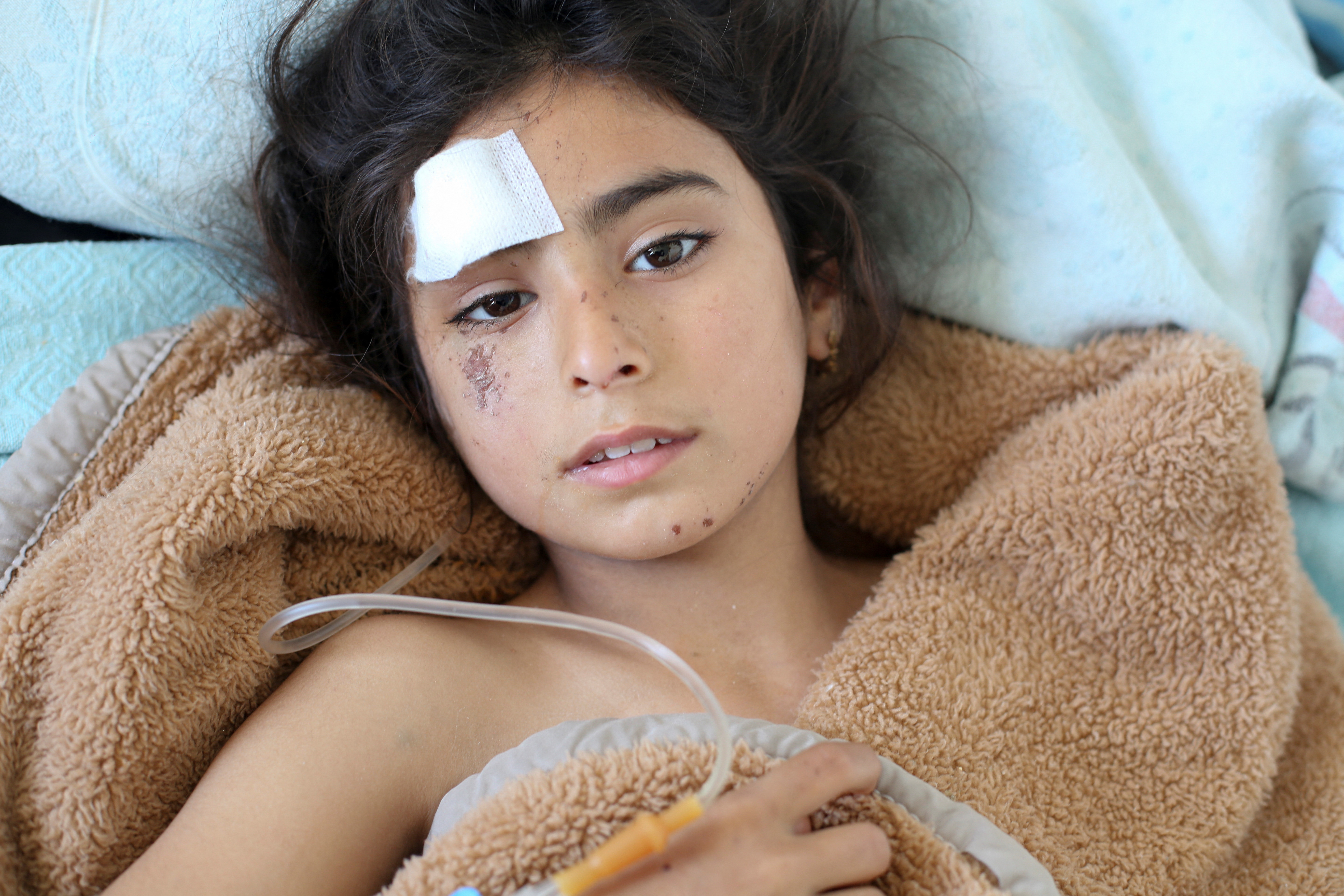 Fatmeh Ahmed al-Issa receives treatment at a hospital in Latakia