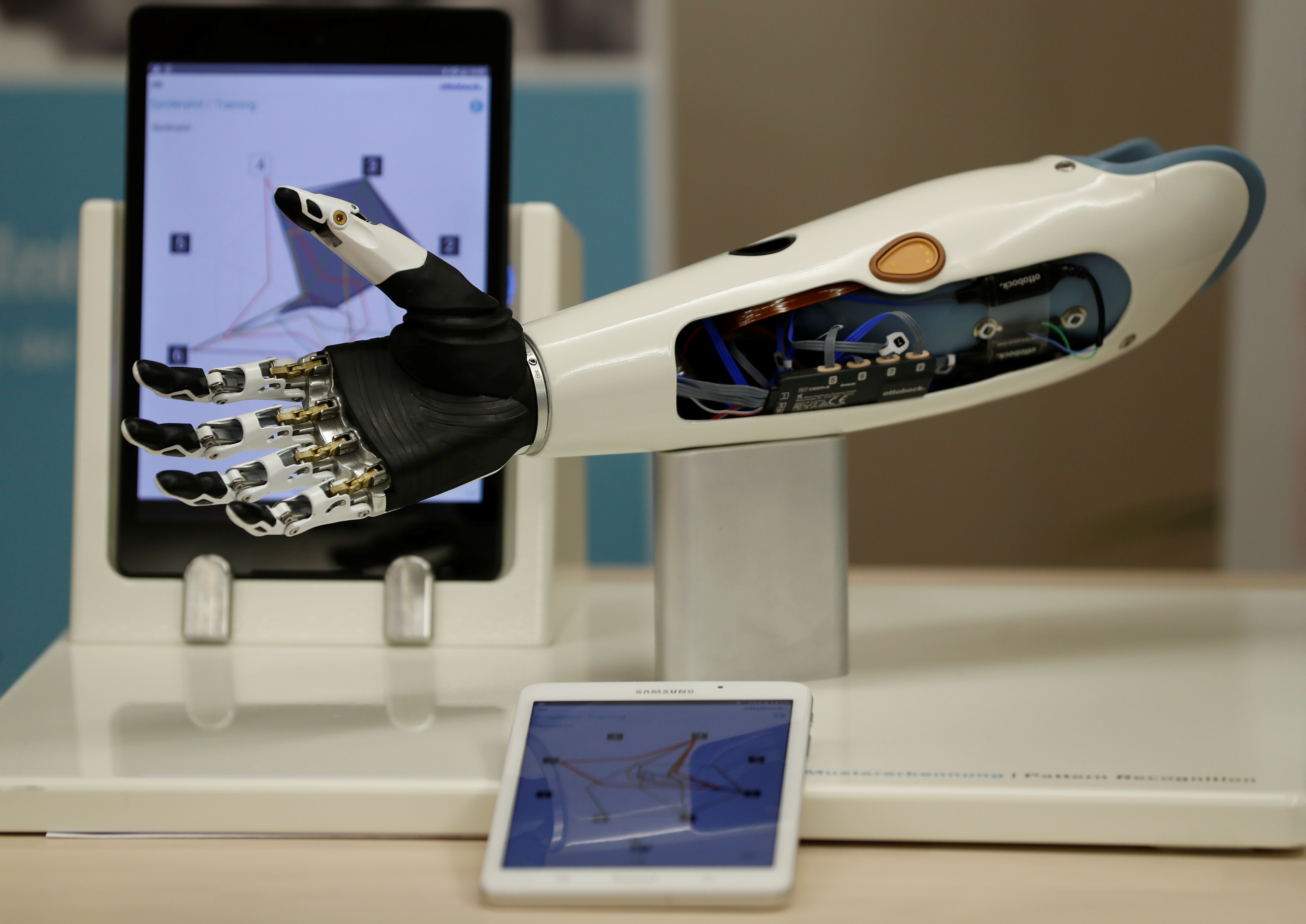 FILE PHOTO - A bebionic hand is seen during the Ottobock media day in Vienna