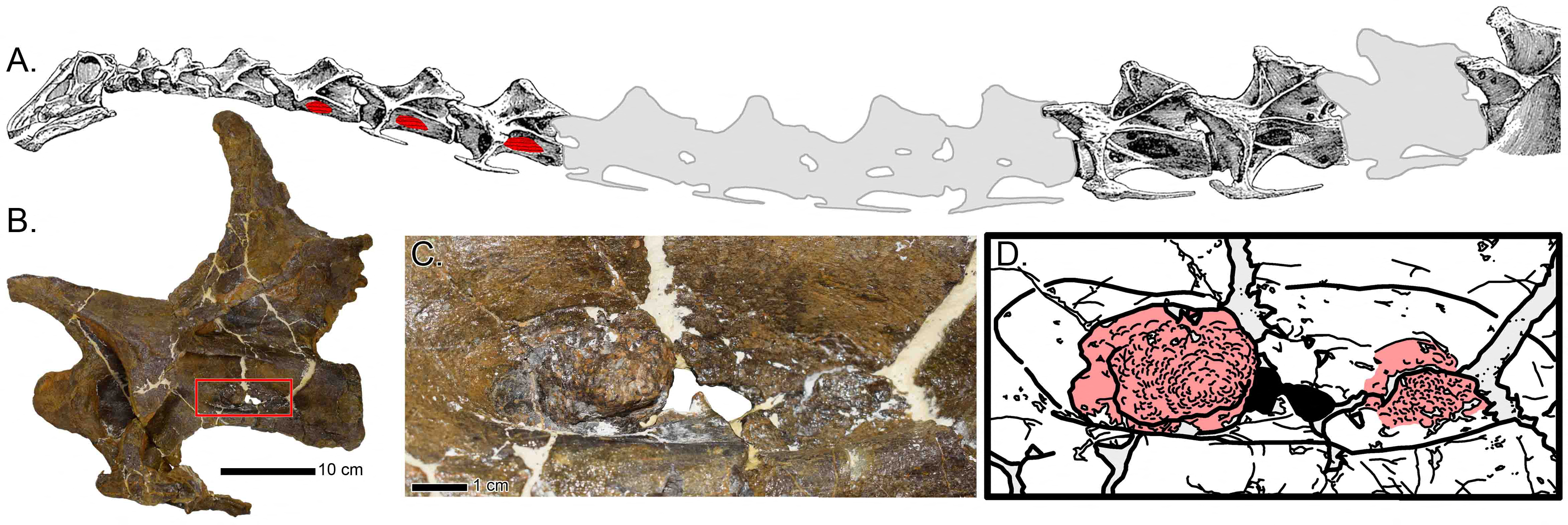 Abnormal bony growths shown in the fossilized vertebrae of a sauropod dinosaur