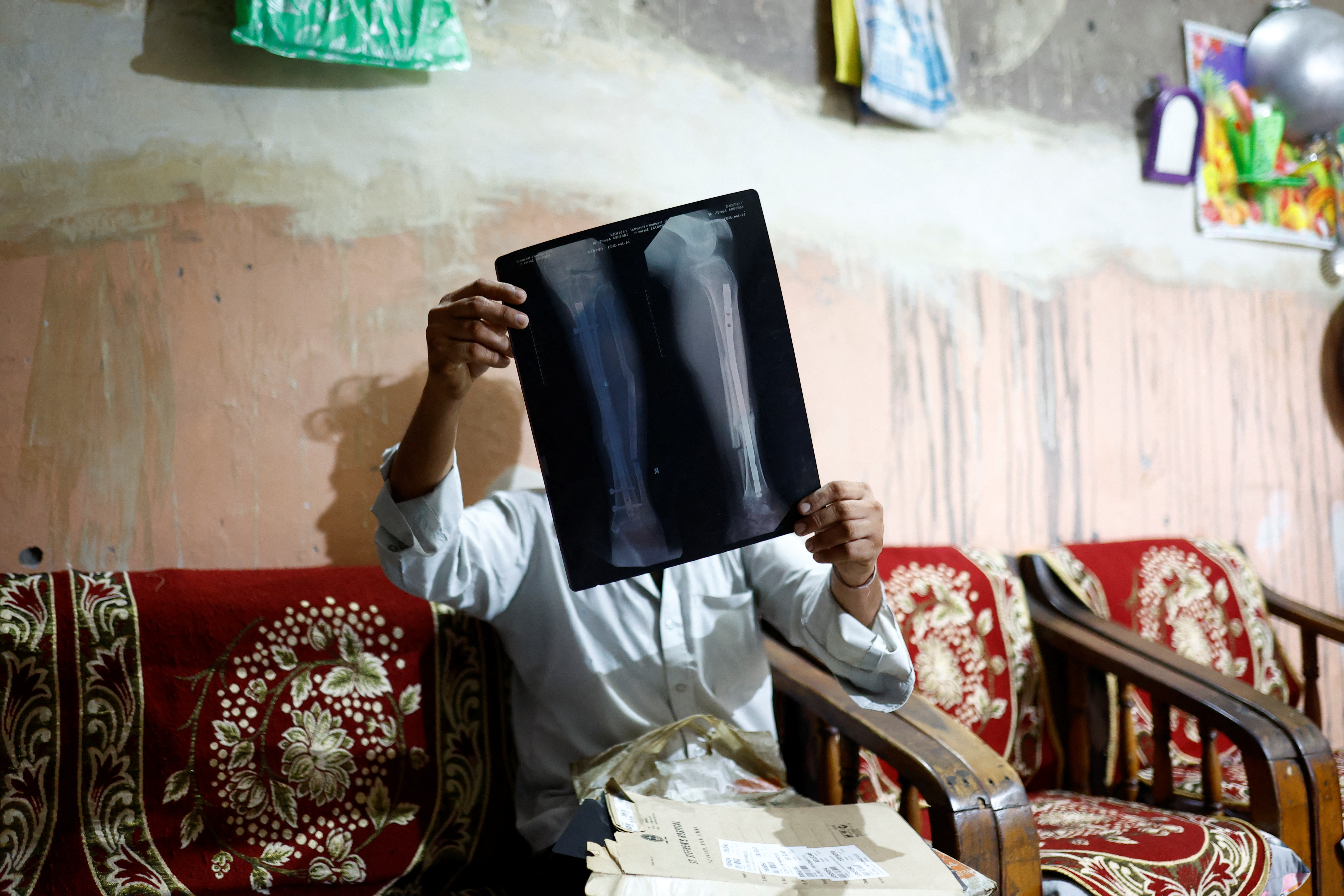 Tofik shows an X-ray of his injured leg at his residence in Loni town in the northern state of Uttar Pradesh