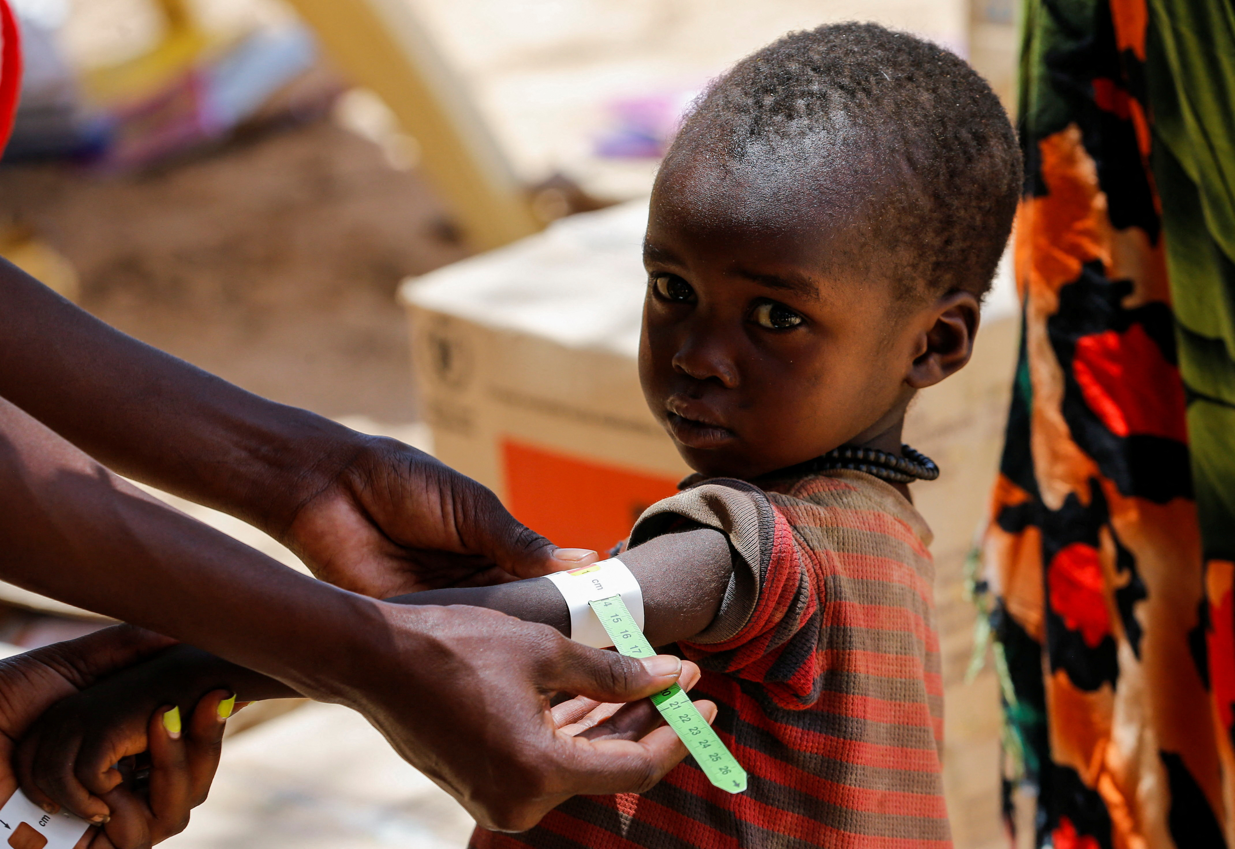 A child from the Turkana pastoralist community affected by the worsening drought due to failed rain seasons, is examined for malnutrition at an integrated outreach medical clinic in Kakimat village in Turkana
