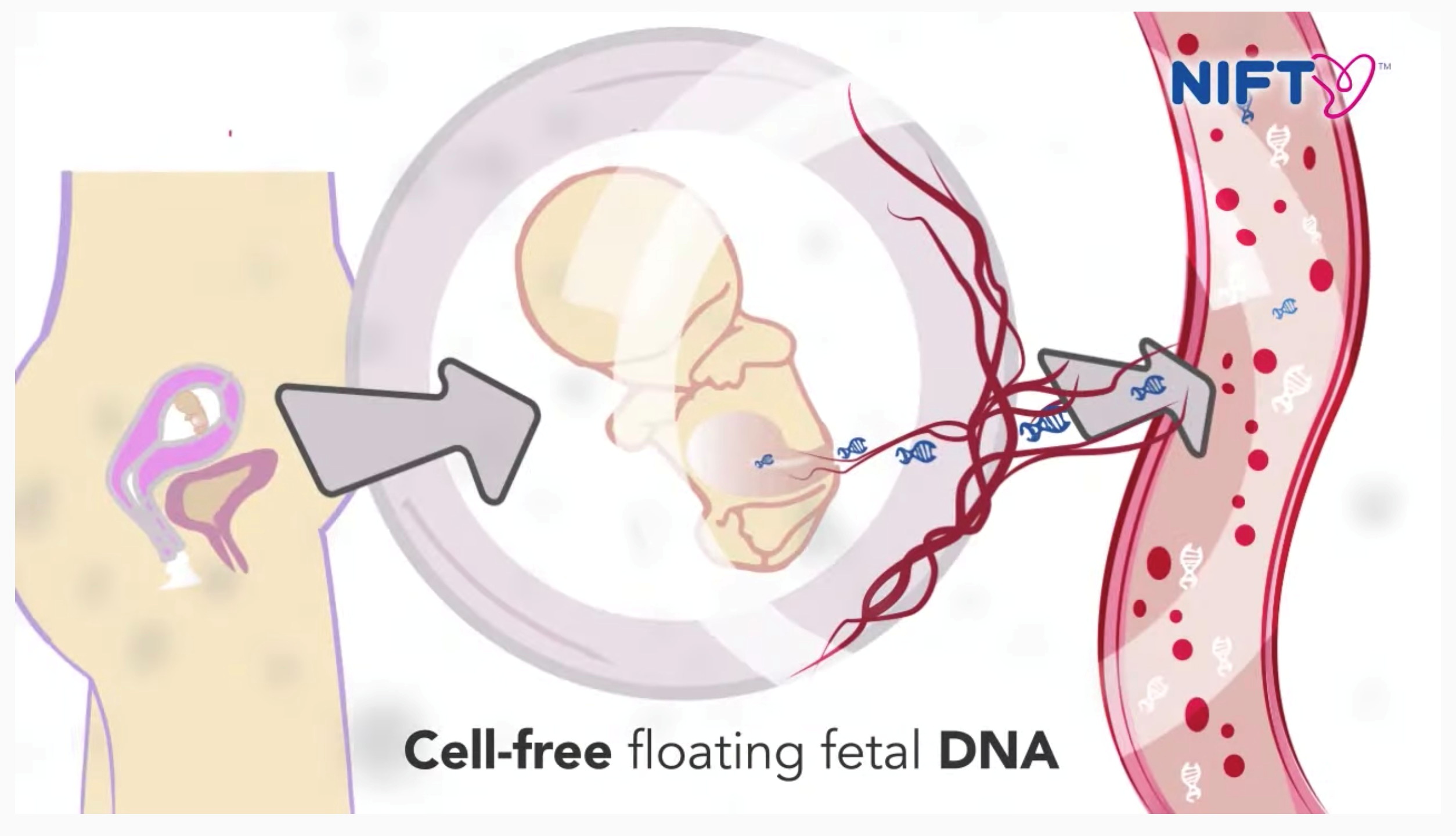 A screenshot from a video posted on the YouTube channel of Chinese gene company BGI in 2014 to promote the company's NIFTY branded prenatal test