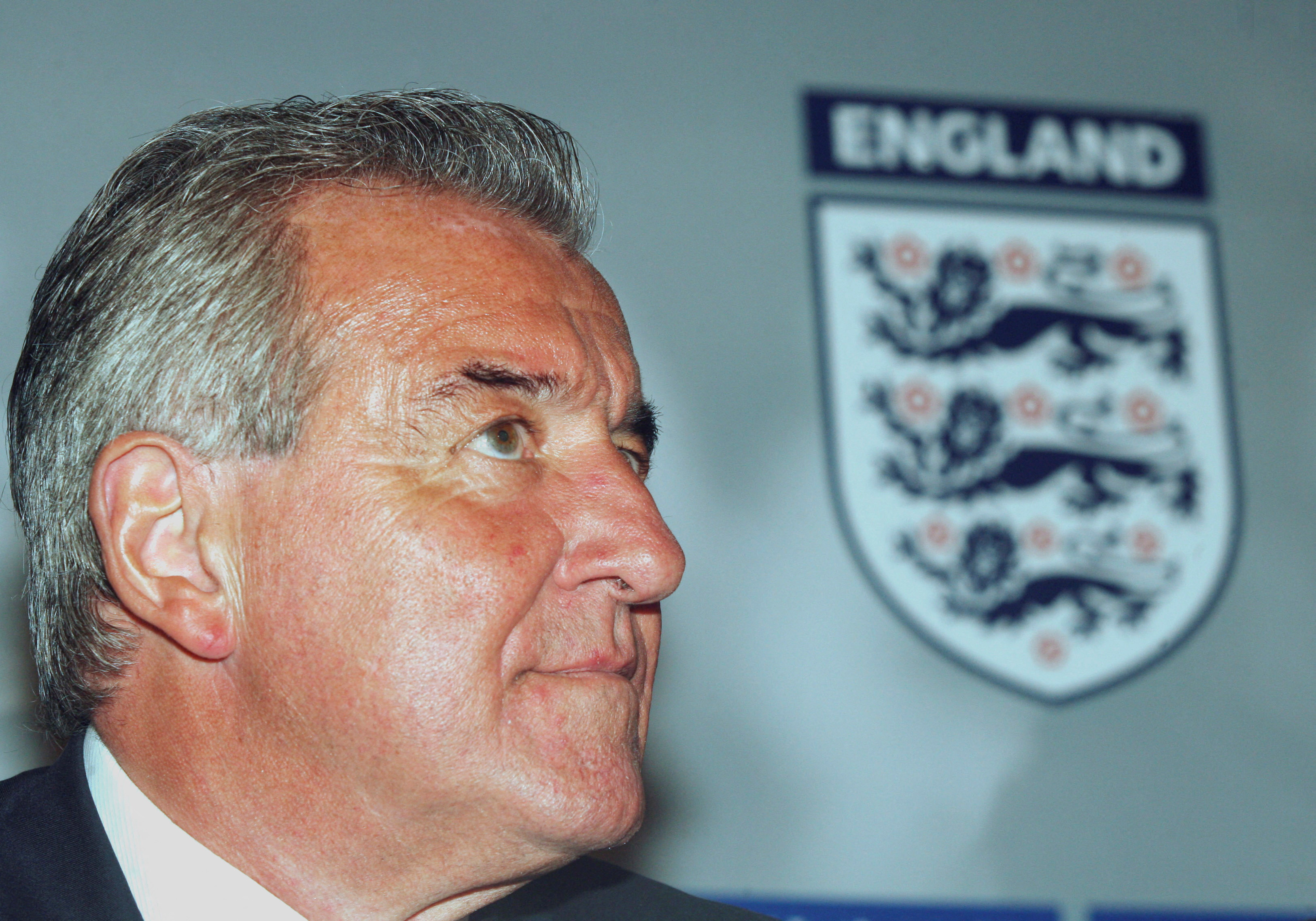 England manager terry venables england hi-res stock photography