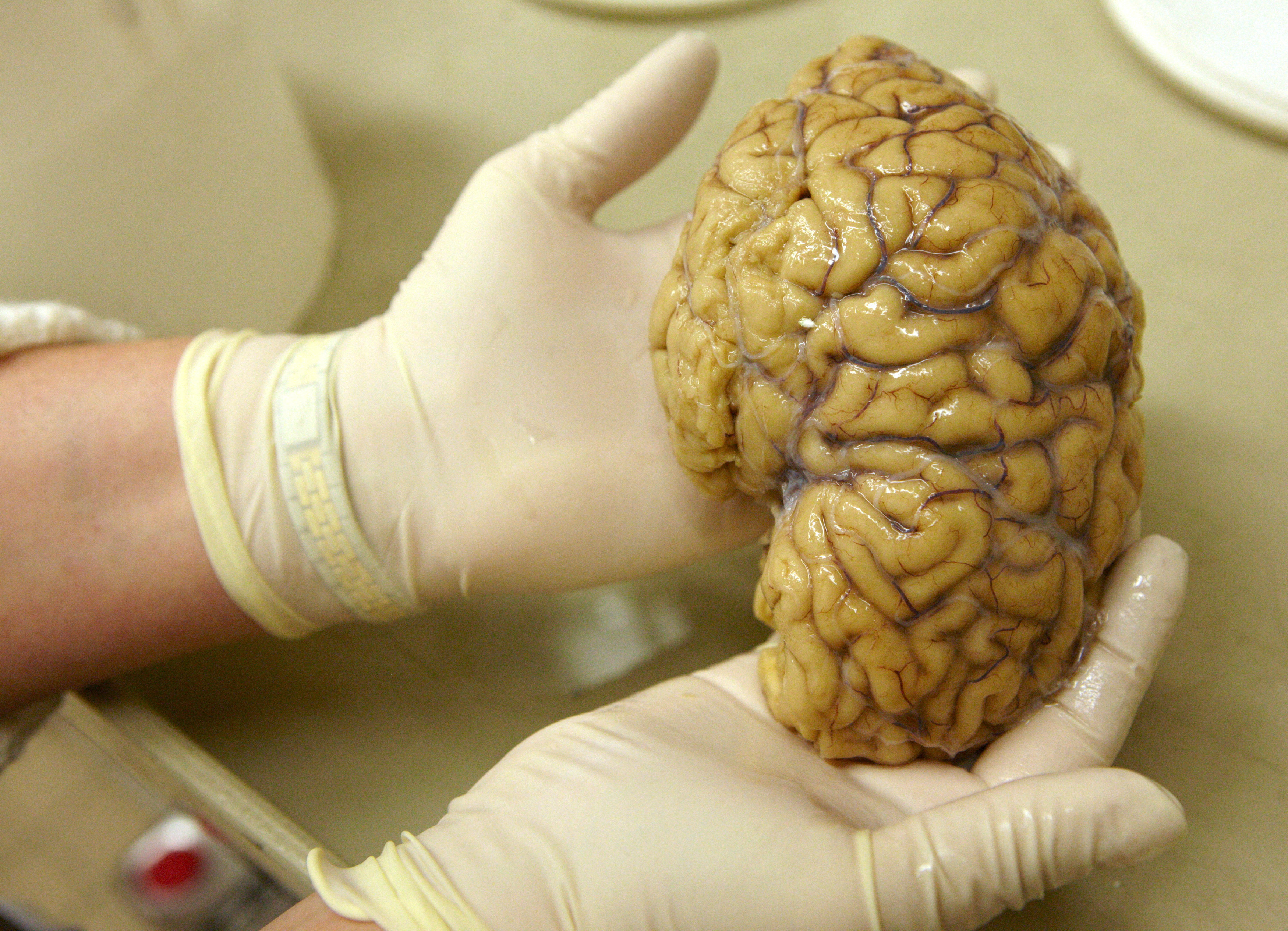 How many neurons make a human brain? Billions fewer than we thought, Neuroscience
