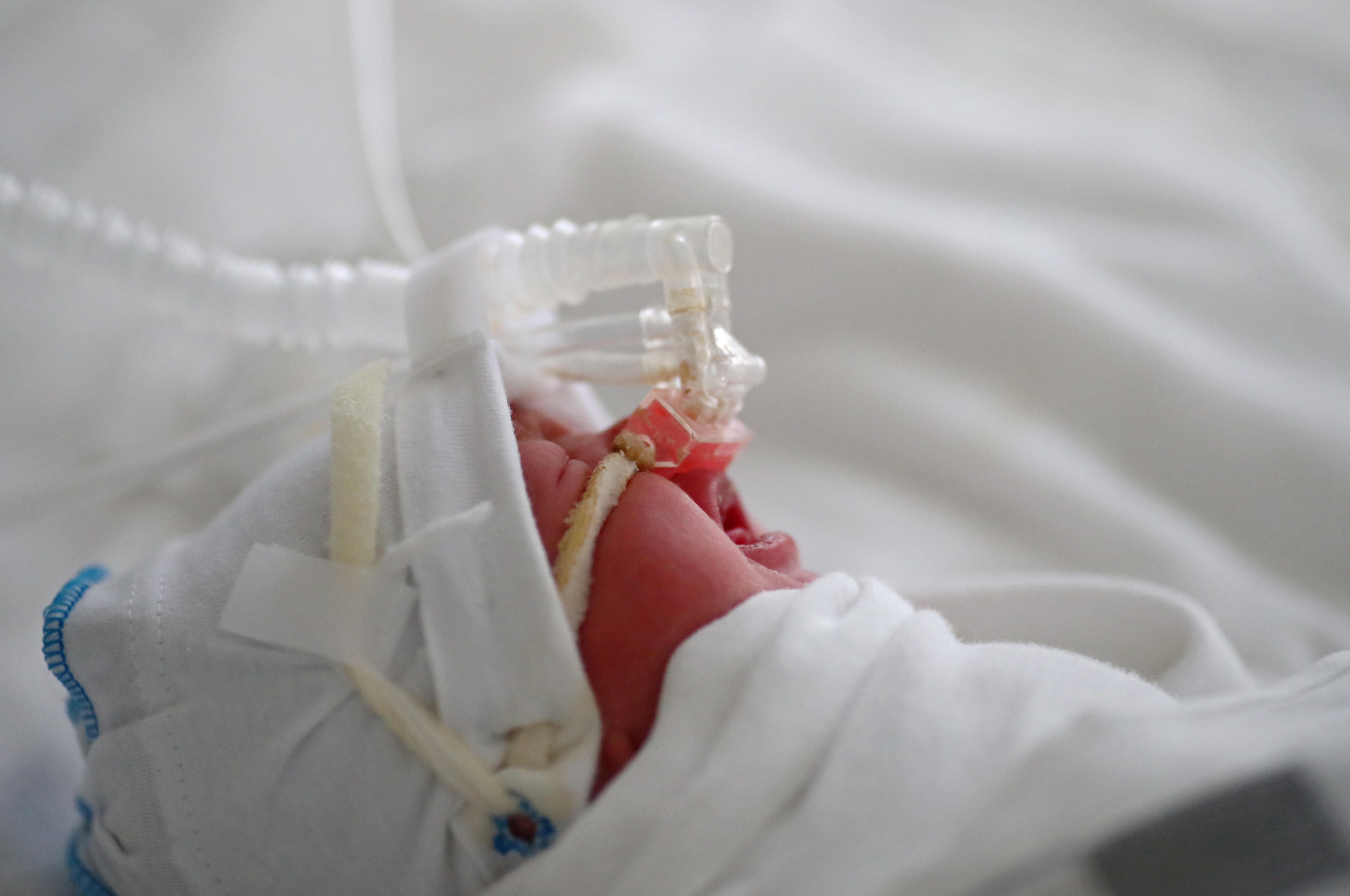 A newborn baby infected with the coronavirus disease (COVID-19) receives oxygen at a maternity hospital in Volgograd, Russia August 19, 2021. REUTERS/Kirill Braga