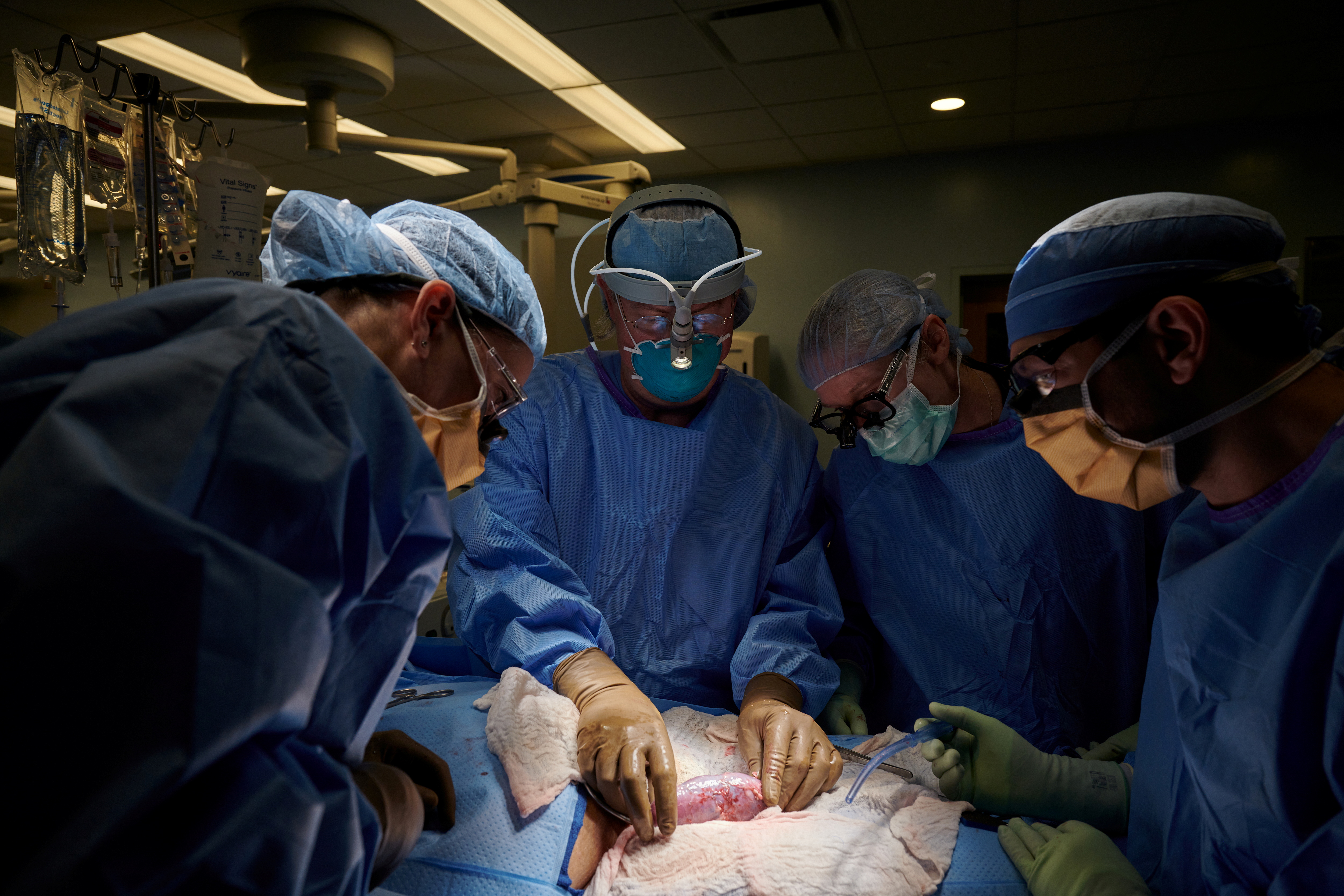 The surgical team examines the pig kidney for any signs of hyperacute rejection, as the organ was implanted outside the body to allow for observation and tissue sampling during the 54-hour study period, at NYU Langone in New York, U.S., in this undated handout photo. Joe Carrotta for NYU Langone Health/Handout via REUTERS .