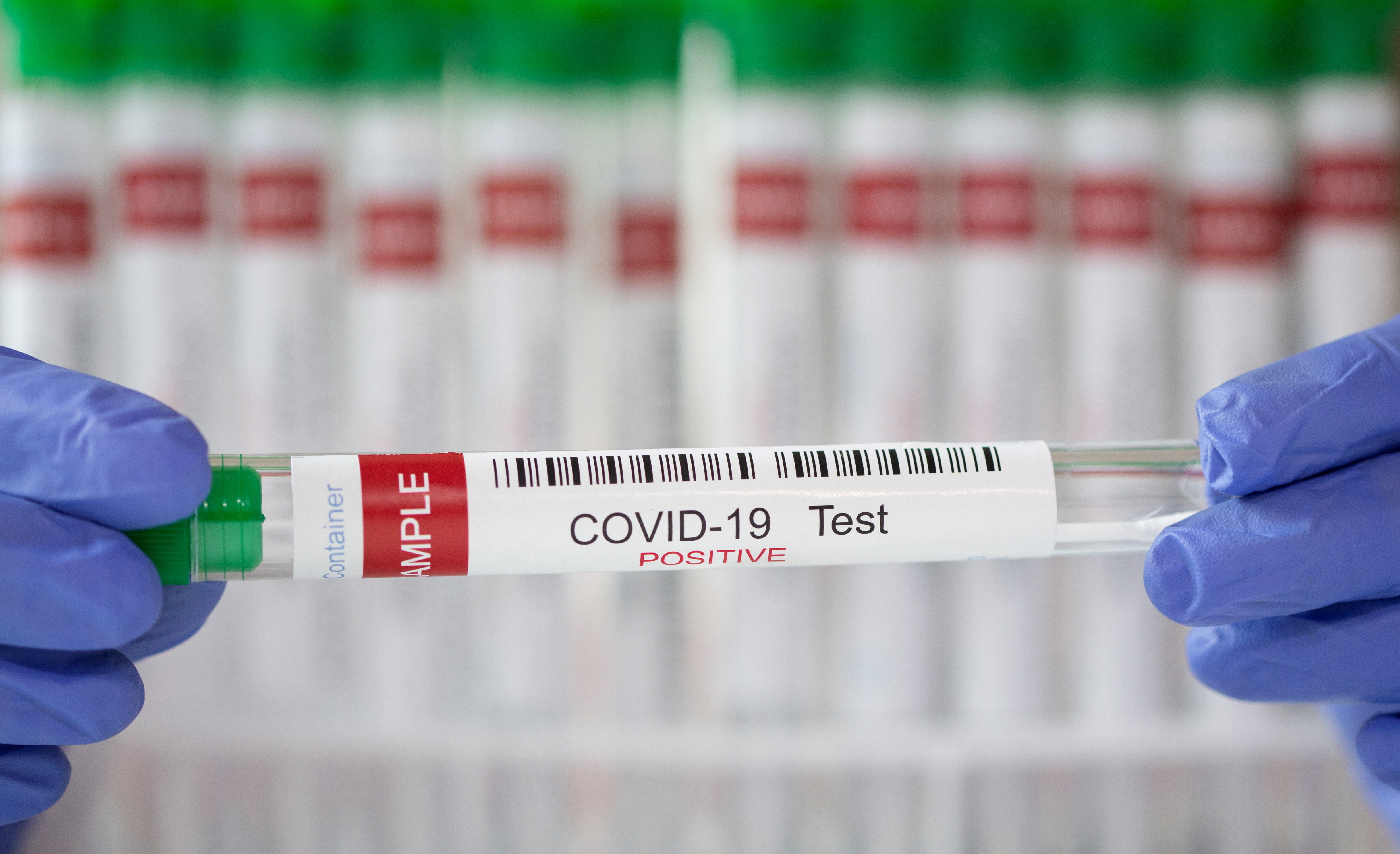 FILE PHOTO: A test tube labelled "COVID-19 Test positive" is seen in this illustration picture