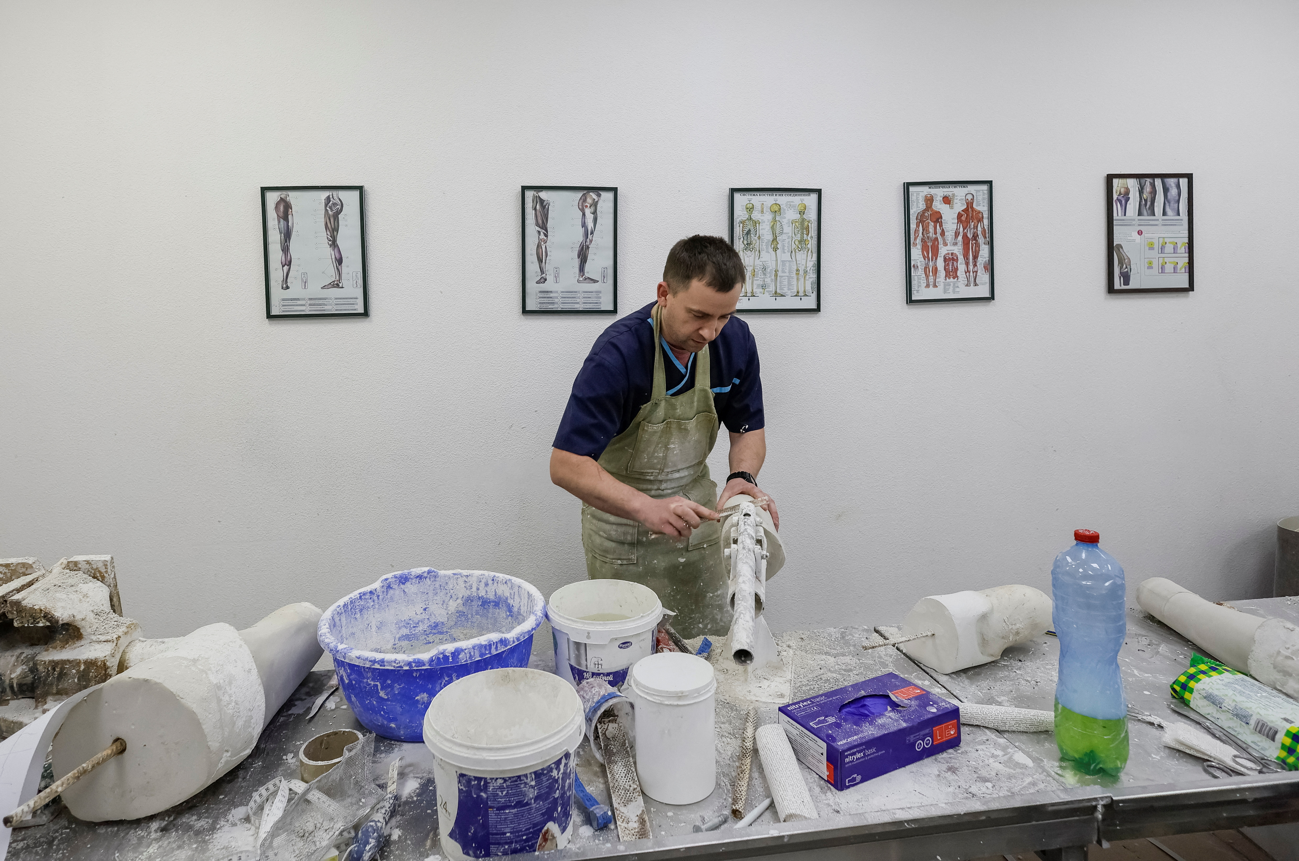 A worker makes a plaster mould for prostheses production in a prosthetics clinic in Kyiv