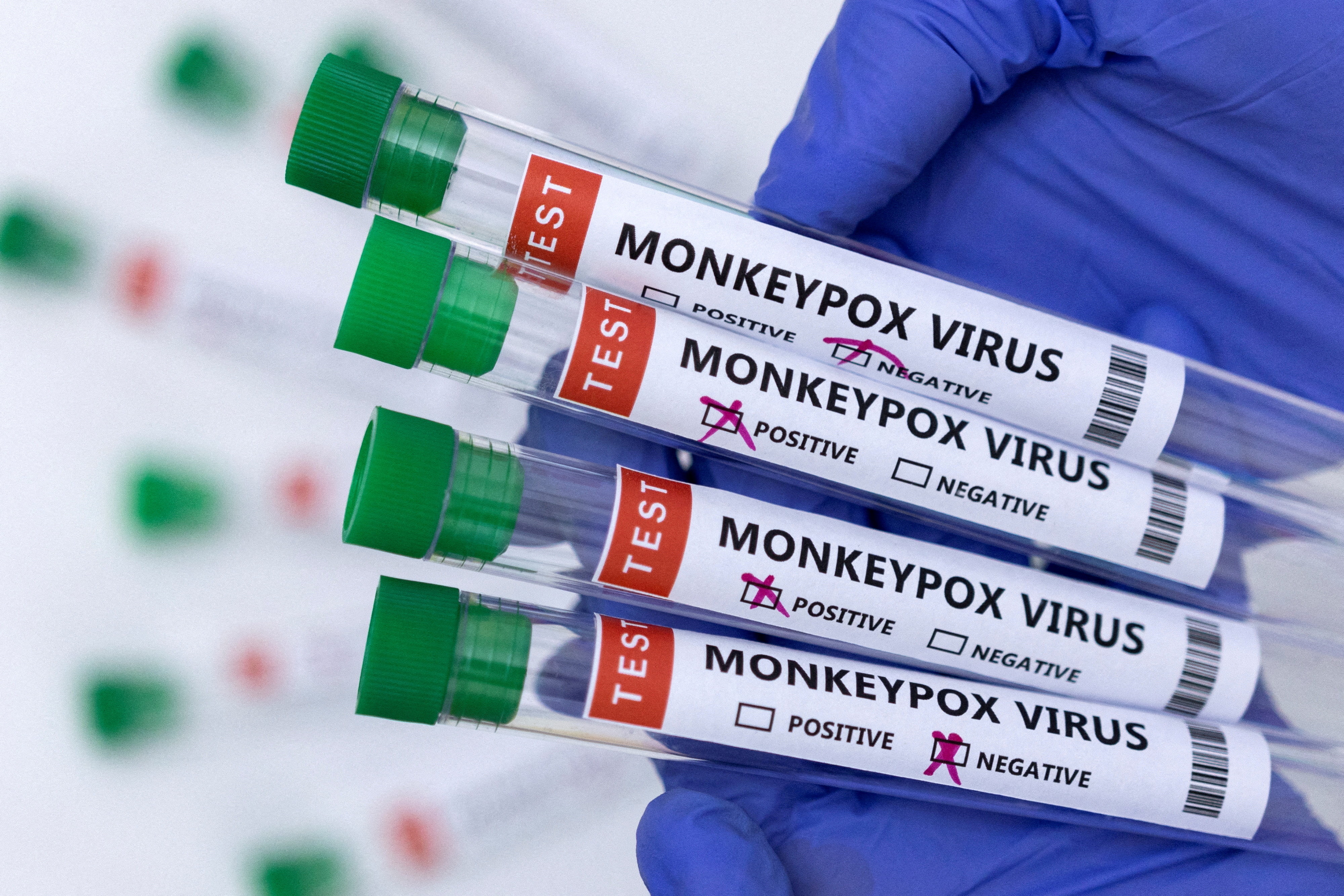 Illustration shows test tubes labelled "Monkeypox virus positive and negative\