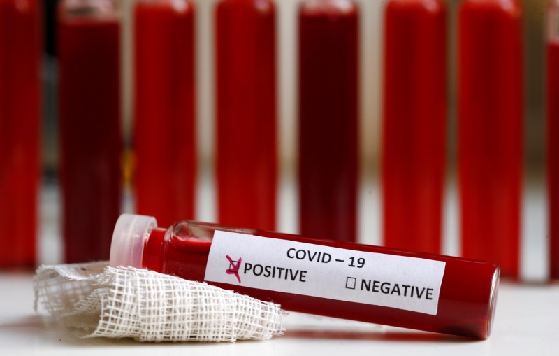Fake blood is seen in test tubes labelled with the coronavirus (COVID-19) in this illustration