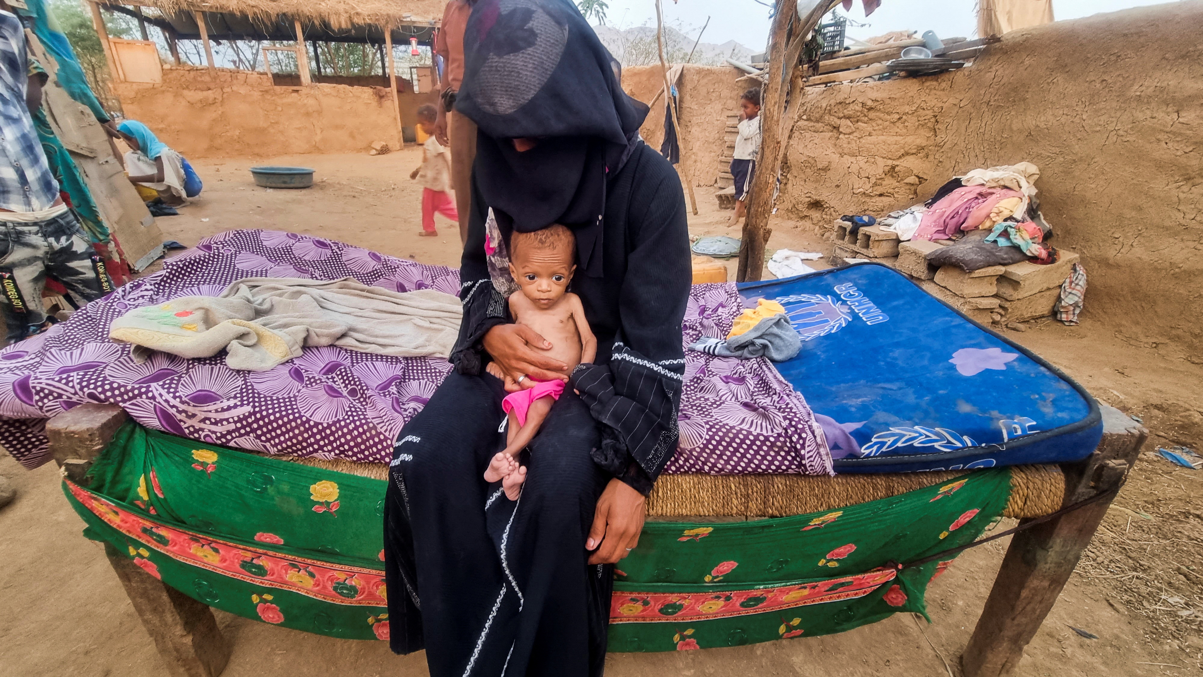Mother of one-year-old malnourished boy Jiad Muhammad Jalal holds him at a camp for internally displaced people in Hajja