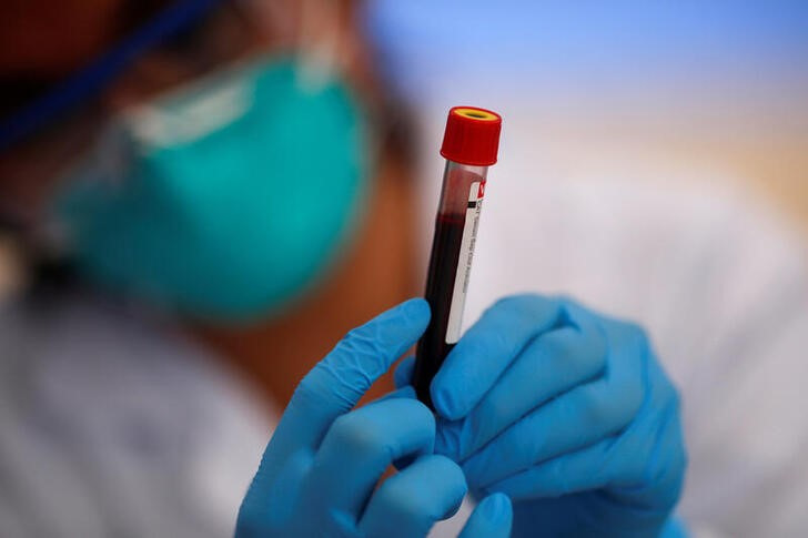 A health worker holds a blood sample while testing municipal workers from the Miraflores district of Lima for the coronavirus disease (COVID-19), in Lima