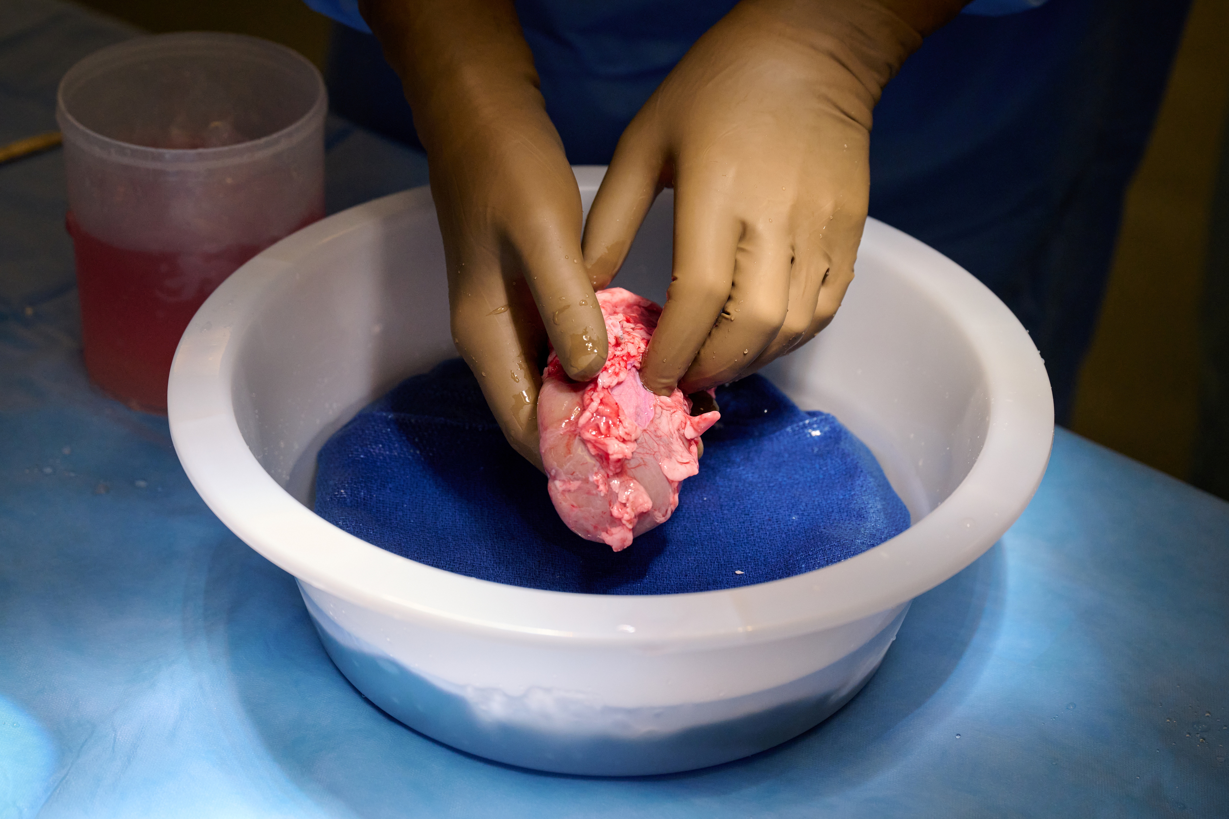 A genetically engineered pig kidney is cleaned and prepared for transplantation to a human at NYU Langone in New York, U.S., in this undated handout photo. Joe Carrotta for NYU Langone Health/Handout via REUTERS