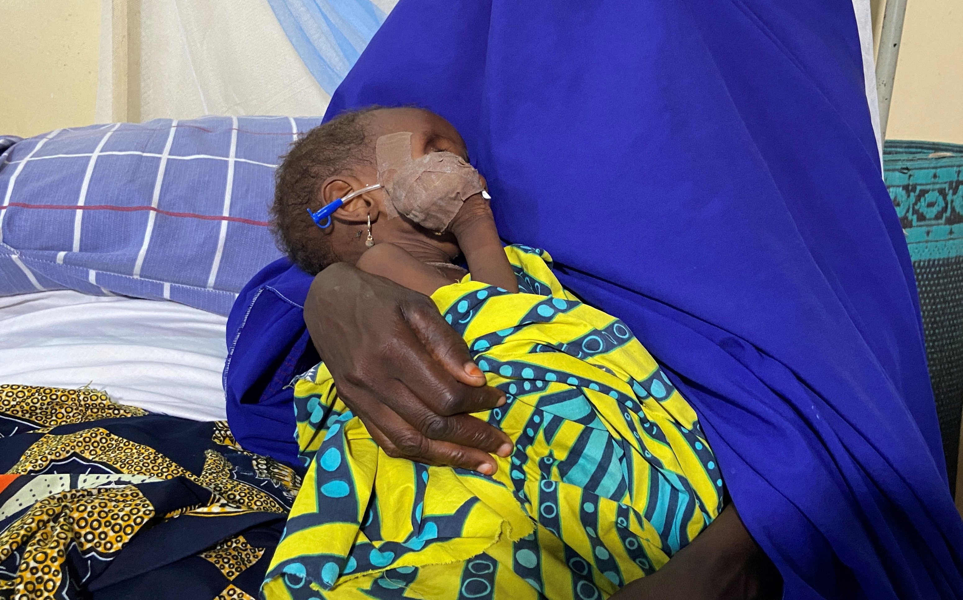 Aisha Usman, a 14-month-old malnourished child, is seen with her mother, Fatima, at a treatment center in Damaturu, Yobe