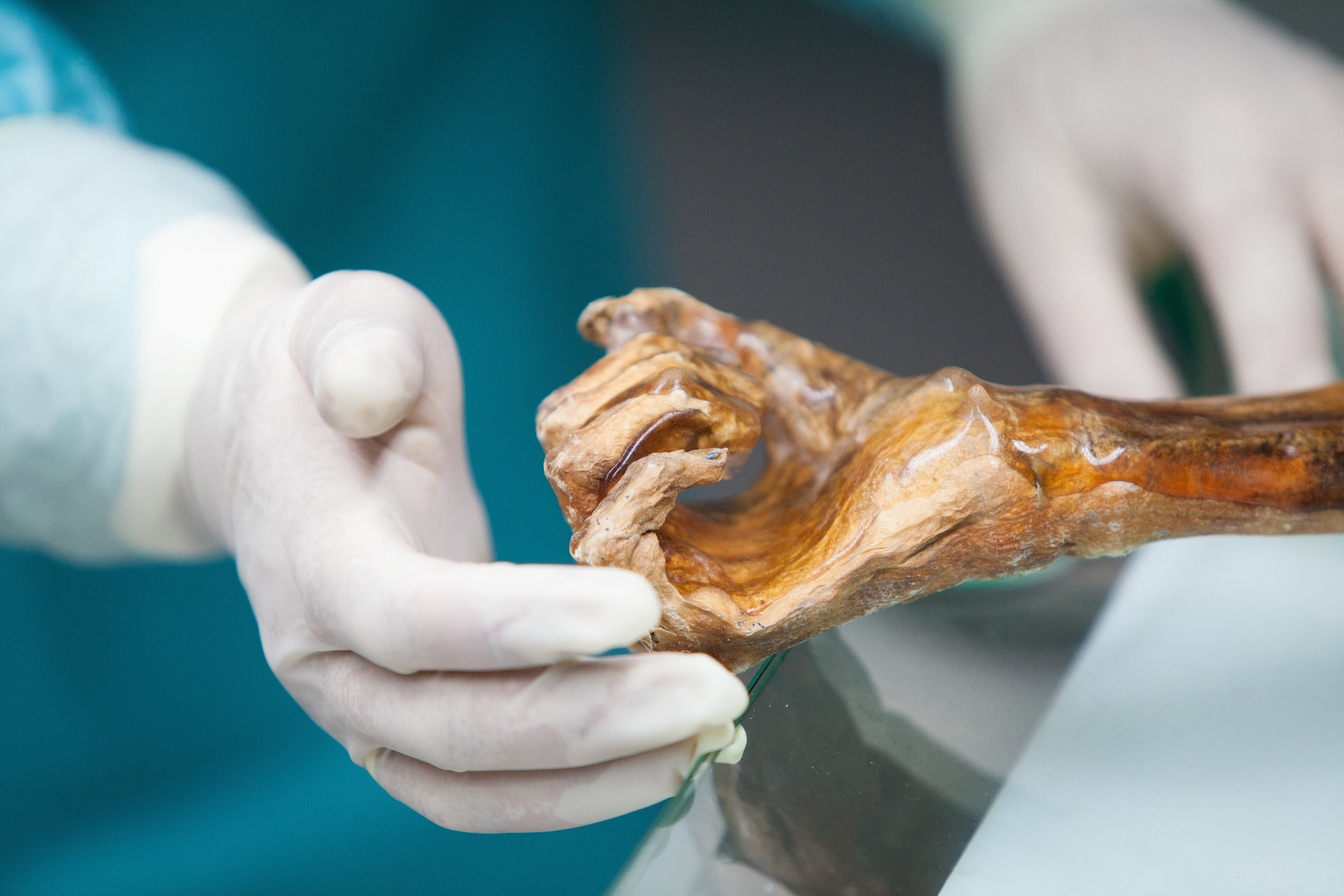 Scientists reveal Ötzi the Iceman's dynamic microbial world | Reuters