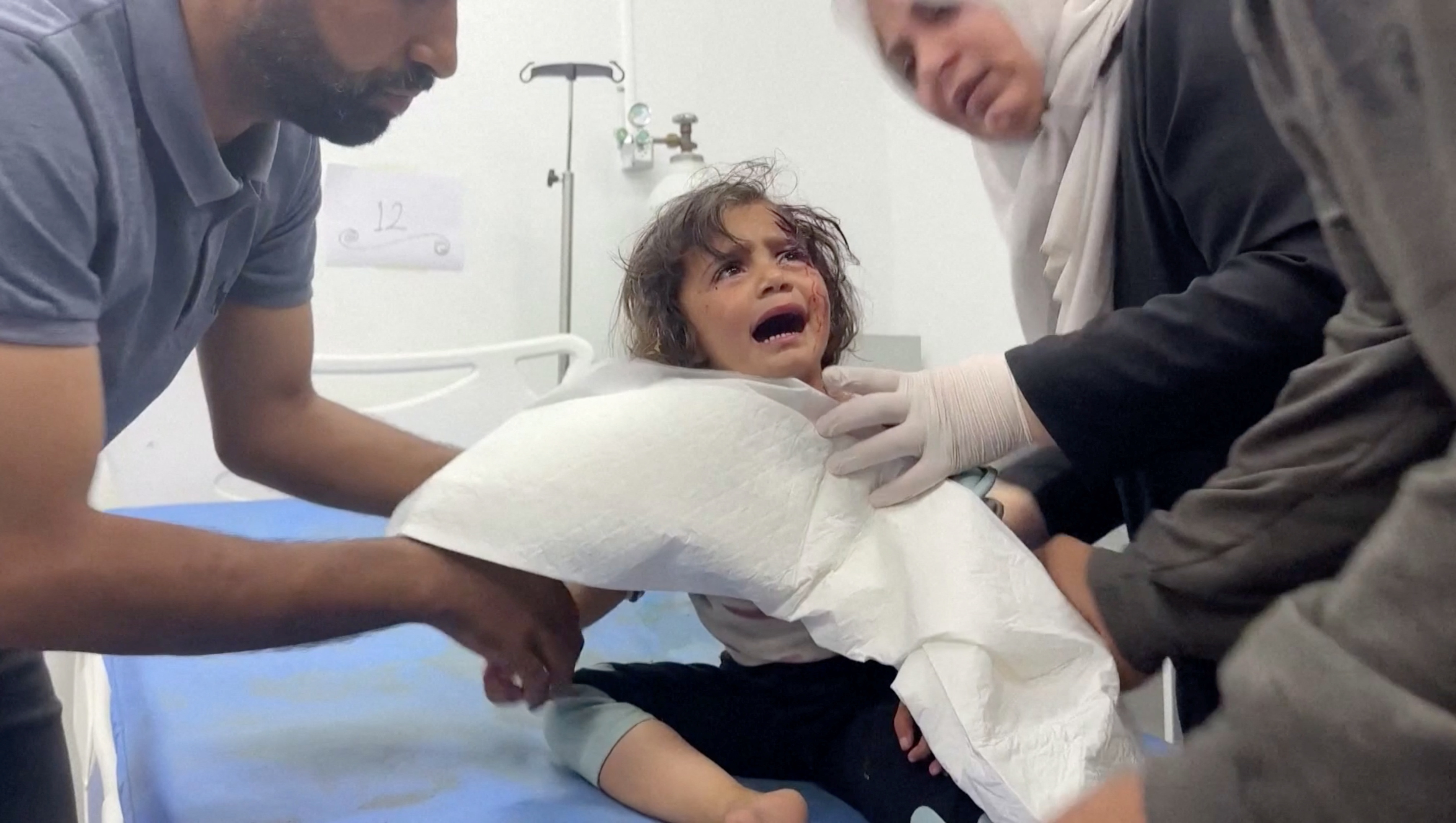 A Palestinian child, wounded in an Israeli strike on an area designated for displaced people, is assisted at a hospital in Rafah
