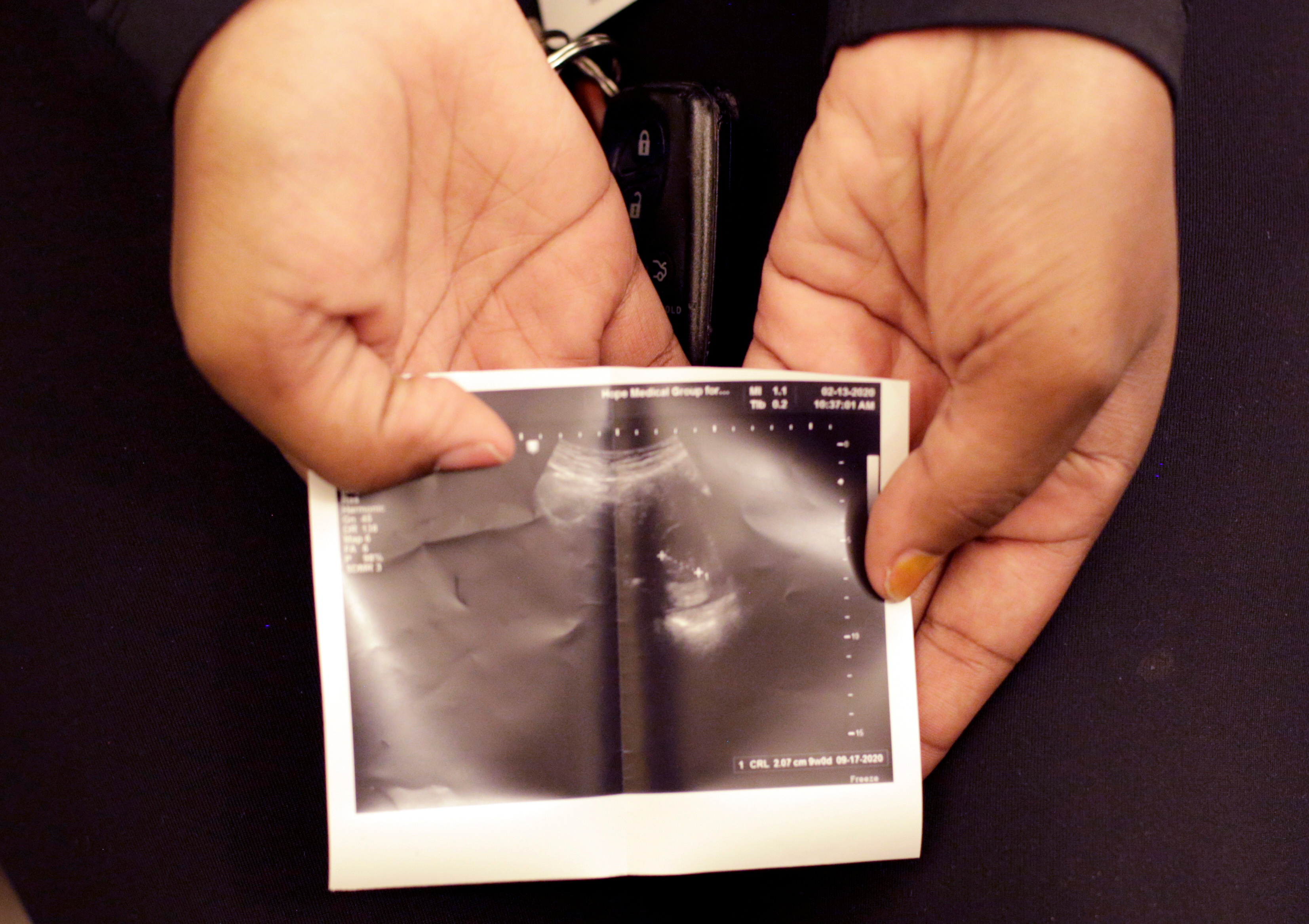 A patient from Texas holds a sonogram that she received at the Hope Medical Group for Women in Shreveport
